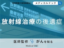 「放射線治療の後遺症」は何がある？副作用を含め対処法を解説！【医師監修】
