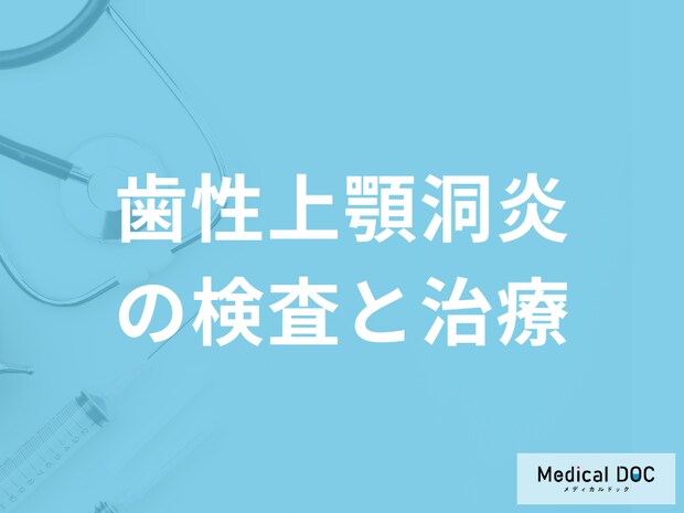 「歯性上顎洞炎」を疑ったら何科へ行けば良いかご存じですか?検査法を医師が解説!
