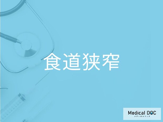 「食道狭窄」の原因をご存じですか? なりやすい人の特徴を併せて医師が解説