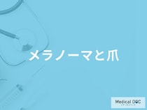 「メラノーマ」を発症すると「爪の形や色」はどのように変化する？【医師解説】
