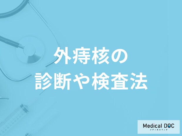 「外痔核」は市販薬で様子見するのは危ない?リスクや検査法を解説!【医師監修】