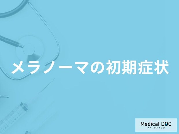 「メラノーマ」の初期症状はご存知ですか？【医師解説】