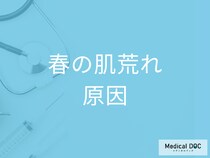 春になると気になる「肌荒れ」の原因は花粉症? なぜ春先は肌が荒れるのか皮膚科医が解説!