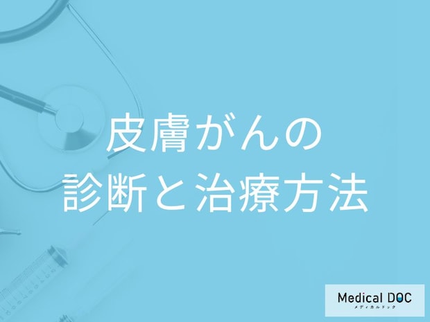 「皮膚がんを疑うほくろ・シミの症状」は何かご存じですか？治療法も医師が解説！