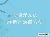 「皮膚がんを疑うほくろ・シミの症状」は何かご存じですか？治療法も医師が解説！