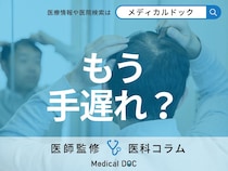 その「薄毛」まだ間に合う!? AGAはどのレベルまで治療できるかご存じですか?