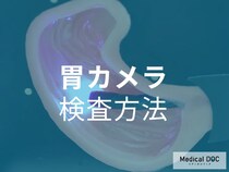 正しく理解して不安を解消!「胃カメラ」の検査方法や見つかる症状について【医師解説】