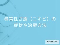 「尋常性ざ瘡（ニキビ）の重症度」はご存じですか？治療法も医師が解説！