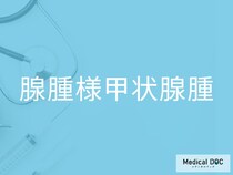 「腺腫様甲状腺腫」の初期症状をご存じですか？ 早期発見のポイントを併せて医師が解説