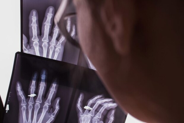 医師とX線写真10