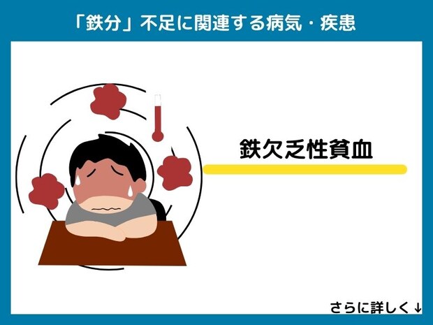 鉄分不足に関連する病気・疾患