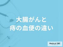「大腸がんと痔の血便の違い」はご存知ですか？医師が監修！