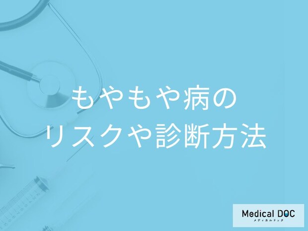 「もやもや病」を放置すると脳にどんなリスクがあるかご存じですか?医師が解説!