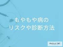 「もやもや病」を放置すると脳にどんなリスクがあるかご存じですか？医師が解説！