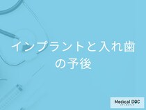「インプラント」と「入れ歯」、それぞれの寿命･ケア･メンテナンスを歯科医が解説