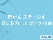 「肺がんステージ4で骨に転移した場合の余命」はご存じですか？症状も医師が解説！