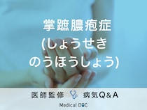 「掌蹠膿疱症」を発症しやすい人の特徴・予防法はご存知ですか？医師が監修！