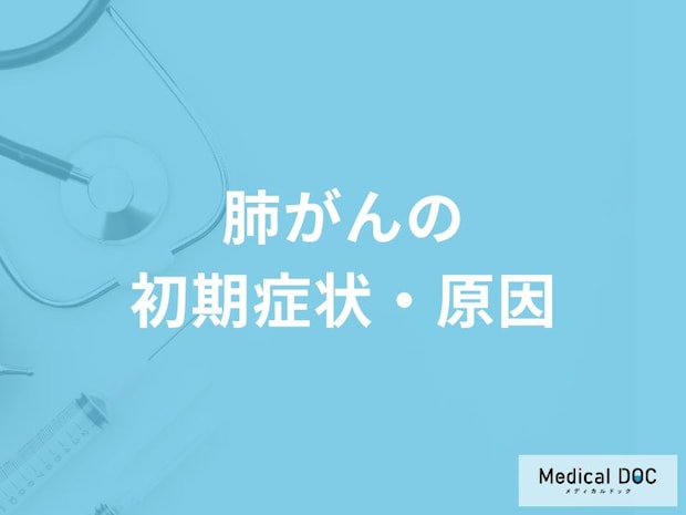 「肺がんを疑う3つの初期症状」はご存知ですか？医師が解説！