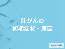 「肺がんを疑う3つの初期症状」はご存知ですか？医師が解説！