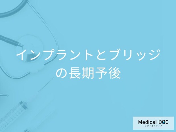 インプラント or ブリッジ、歯の健康にとっていいのはどっち? 歯科医が答えます