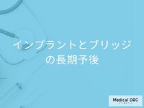 インプラント or ブリッジ、歯の健康にとっていいのはどっち? 歯科医が答えます