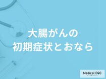「大腸がんの初期症状」と「おなら」の関係性とは？医師が監修！