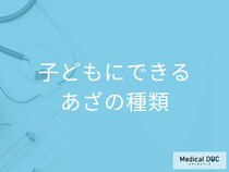 子どもにできる「あざ」には種類があることをご存じですか? それぞれの特徴を医師が解説!