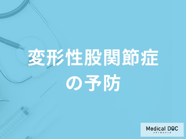 「変形性股関節症の予防法」は何かご存知ですか？医師が監修！
