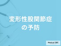「変形性股関節症の予防法」は何かご存知ですか？医師が監修！