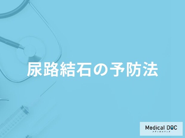 「尿路結石を予防」するおすすめの食べ物や飲み物はご存知ですか？【医師監修】
