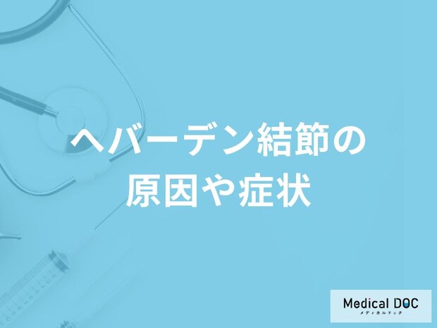 「へバーデン結節の原因」はご存知ですか？症状や放置するとどうなるかも解説！