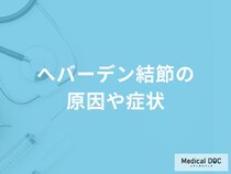 「へバーデン結節の原因」はご存知ですか？症状や放置するとどうなるかも解説！