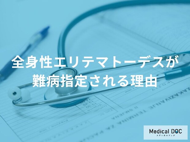 全身性エリテマトーデスが難病指定される理由と背景