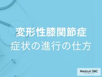 「変形性膝関節症」の初期症状をご存じですか？進行のサインも医師が解説