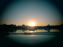 【闘病】定期的に眼科検診を受けながら｢緑内障｣になっていたワケ