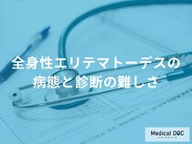 「全身性エリテマトーデス」になぜ気づけない？ 診断が遅れる理由と検査の重要性
