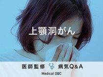 「上顎洞がん」を疑う鼻の症状はご存知ですか？医師が監修！
