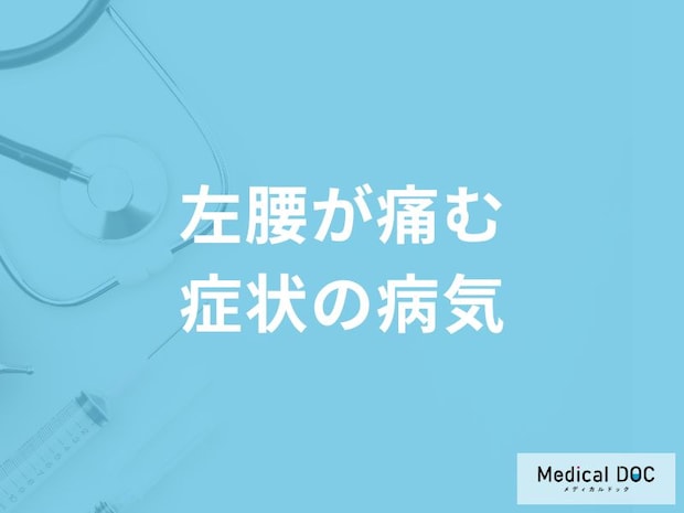 「左腰が痛む」症状で考えられる病気はご存知ですか？【医師解説】