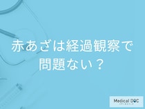 子どもの赤あざ「経過観察で問題ない」は過去の話? 早めに治療するメリットを医師が解説!