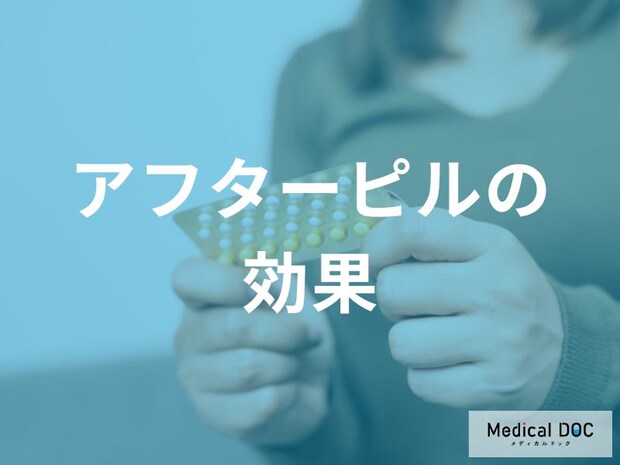 アフターピルの効果は「時間との戦い」避妊成功率が変わる理由とは