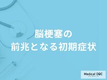「脳梗塞の前兆となる4つの初期症状」はご存知ですか？【医師解説】