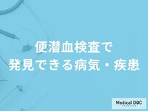 「便潜血検査」で「大腸がん」が見つかる確率はご存知ですか？医師が解説！