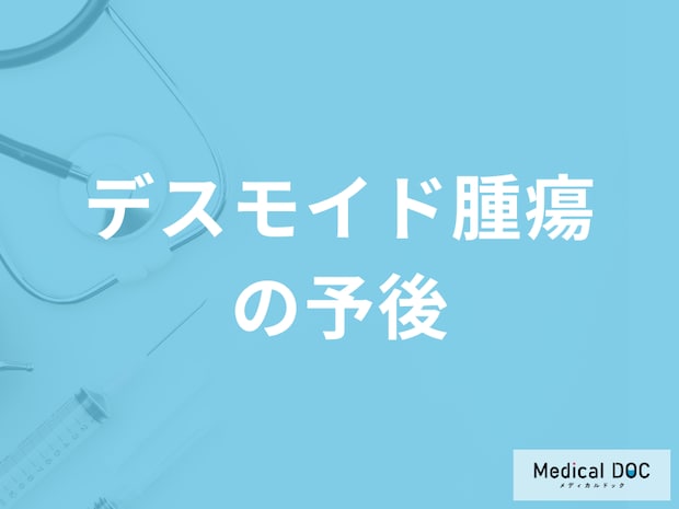 希少がん「デスモイド腫瘍の余命」はどのくらいかご存じですか？予後を医師が解説！