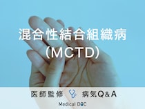 「混合性結合組織病（MCTD）」とは？症状や原因について医師が解説！