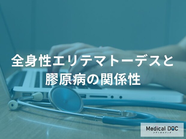 「全身性エリテマトーデス」とほかの“膠原病”の違い なぜ全身に症状が広がるのか?