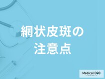 「網状皮斑の注意点」は何かご存じですか？治療法も医師が解説！