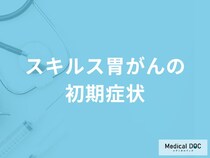 「スキルス胃がんの3つの初期症状」はご存知ですか？【医師解説】