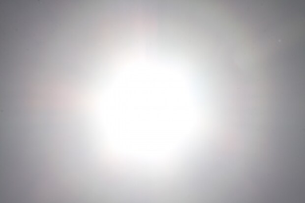 ドライアイの初期症状