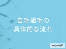 自分の髪の毛を移植する「自毛植毛」とは? 具体的な治療の流れを医師が解説!