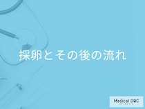 体外受精の「採卵」はどうやっておこなうの? 着床までの流れを医師が解説!